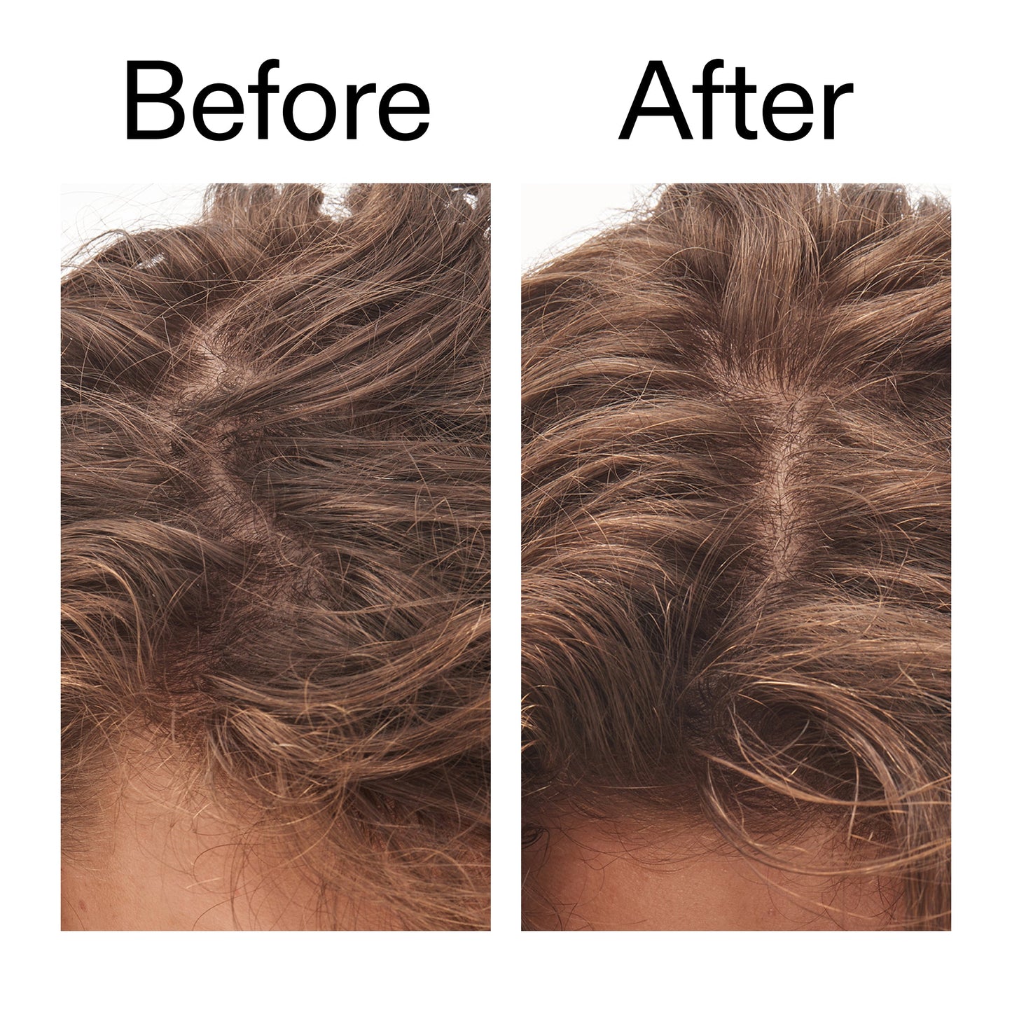 glycolic-acid-exfoliating-scalp-scrub-h6 Glycolic_Acid_Exfoliating_Scalp_Scrub_Before_After_2000x2000_b8561c87-05a1-4caa-80f7-1b6b33d750f7.jpg