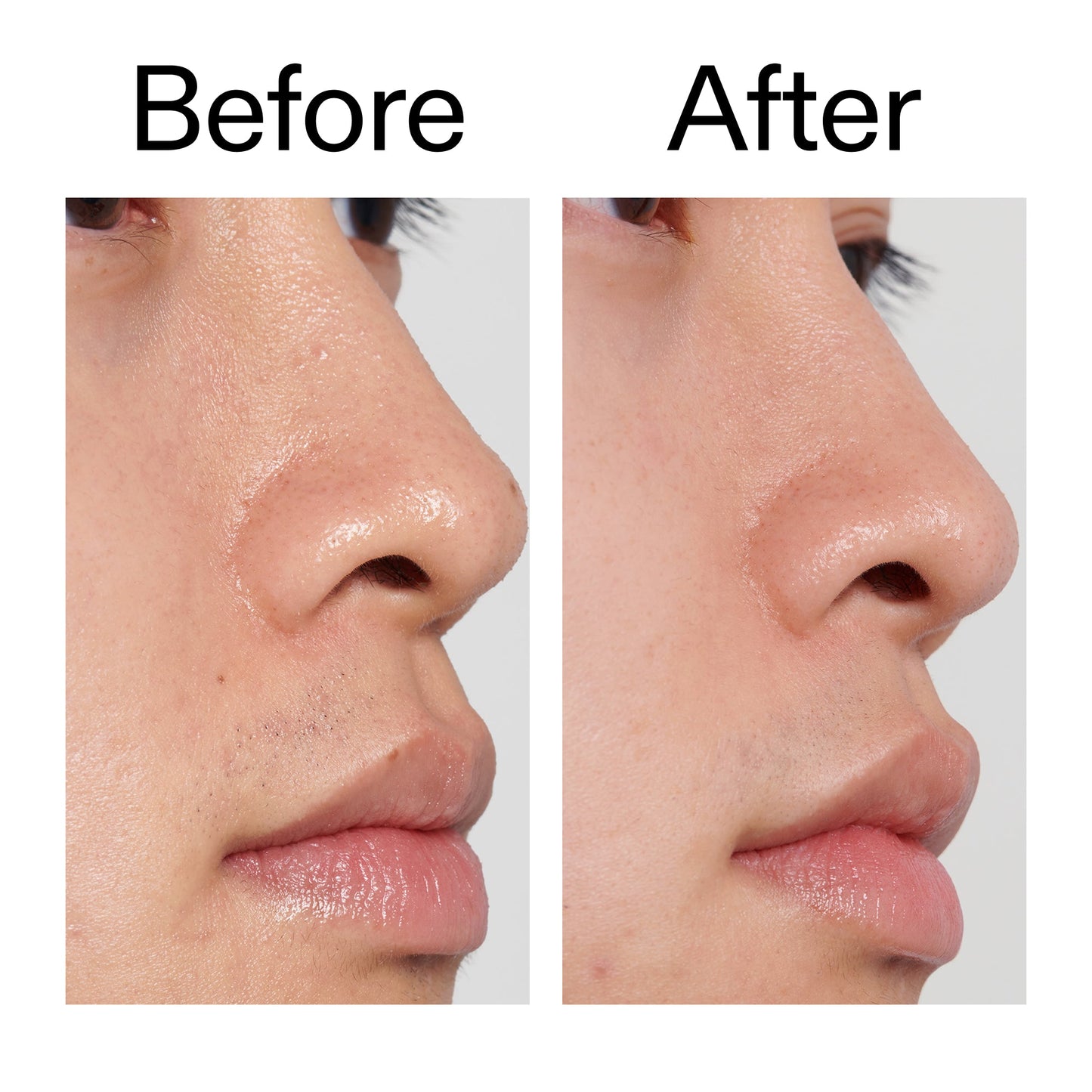 pha-toner-n8 PHA_Toner_Before_After_2000x2000_e3c10172-0150-4342-8b95-57417eaff50d.jpg