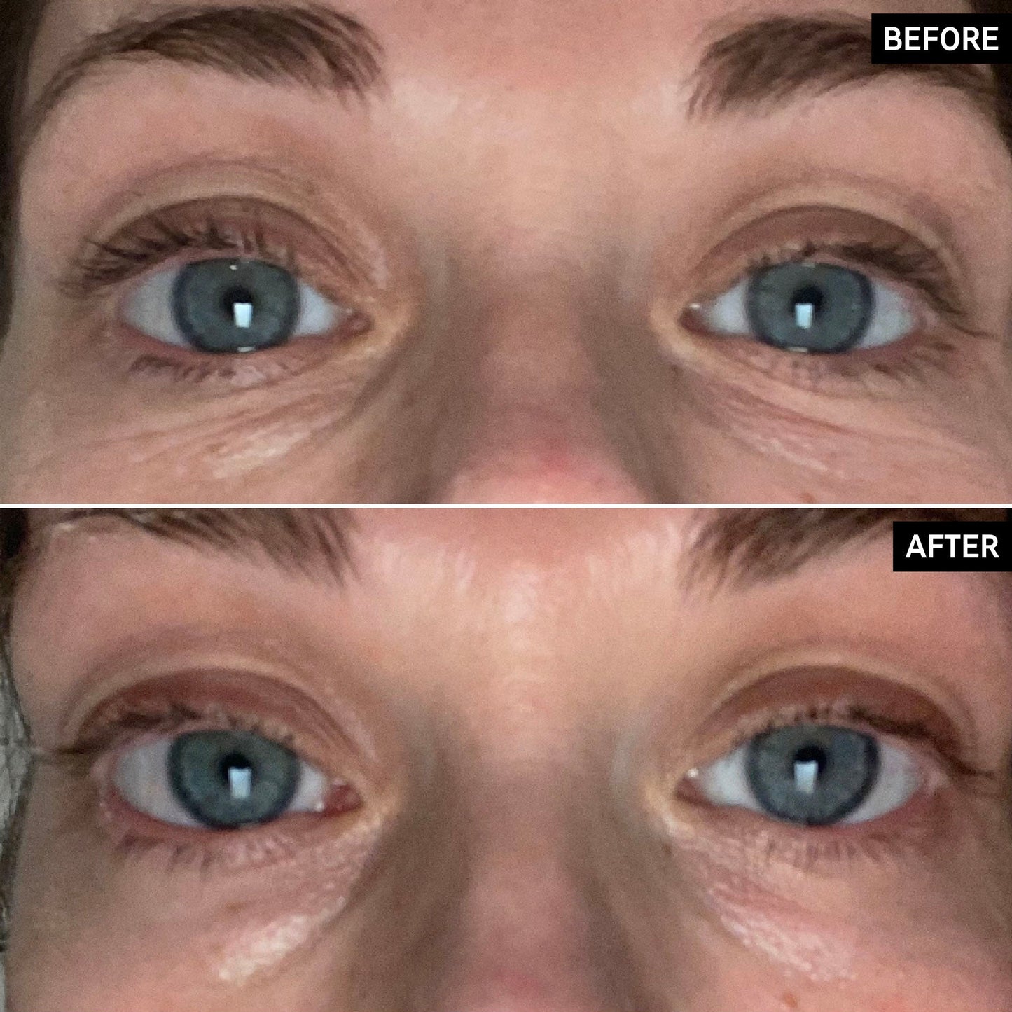 retinol-eye-cream-r1 SITE-UGCBAsApril_Nicole_B_A_PPage_2000x2000_1.jpg