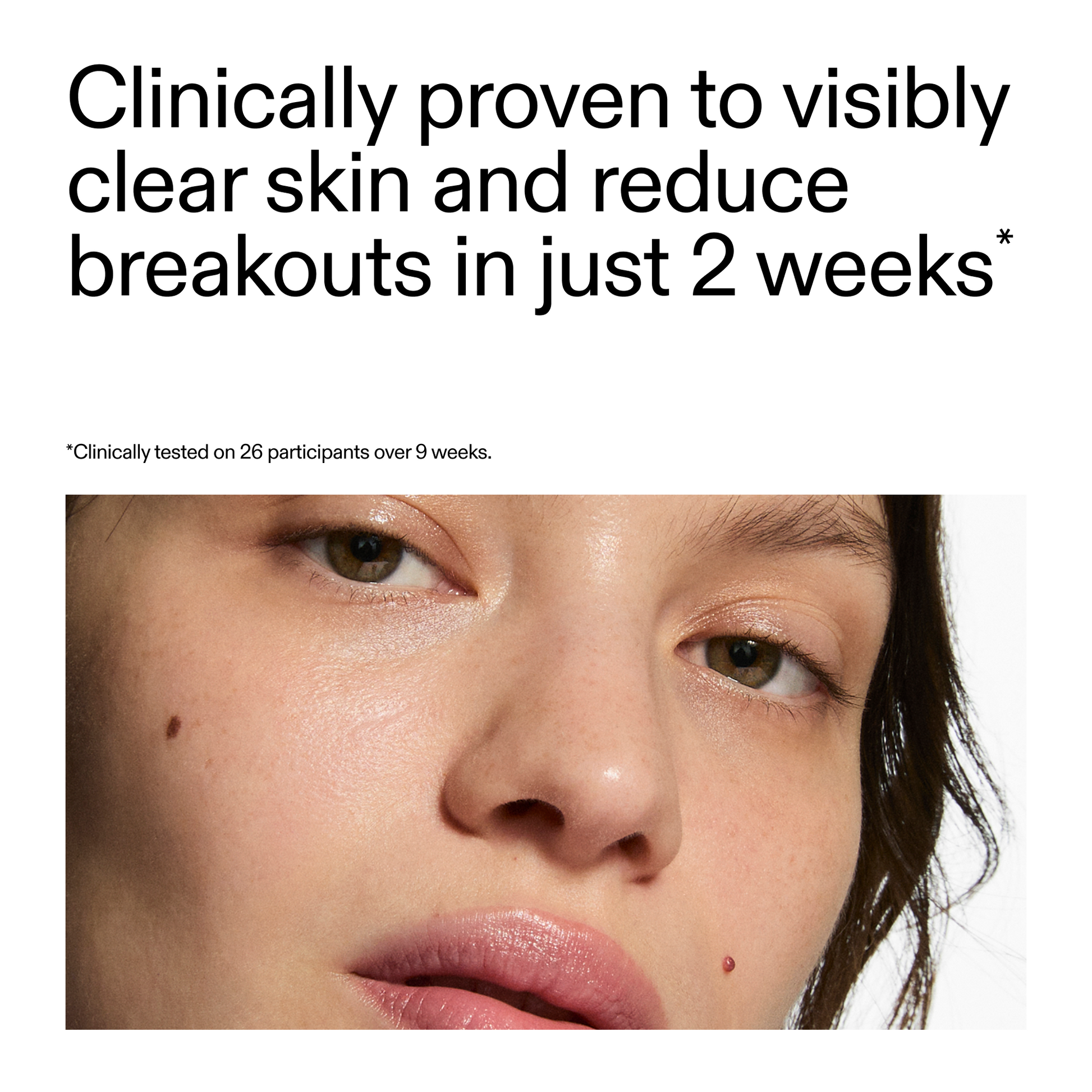 360-acne-clearing-duo-d1 360_Serum_Key_Claim.png