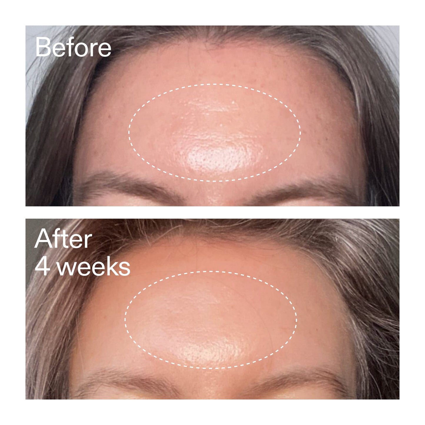 advanced-0-2-retinal-serum-h9 AdvancedRetinal_BeforeAfter1_2000x2000_1da6bb0a-29dd-41d1-95b7-8679696bbf0f.jpg