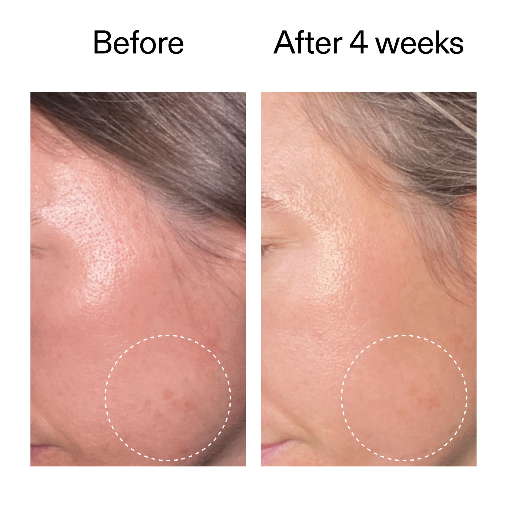 advanced-0-2-retinal-serum-h9 AdvancedRetinal_BeforeAfter2__2000x2000_62fb16bb-77ae-4d63-8500-88dbf847f4b9.jpg