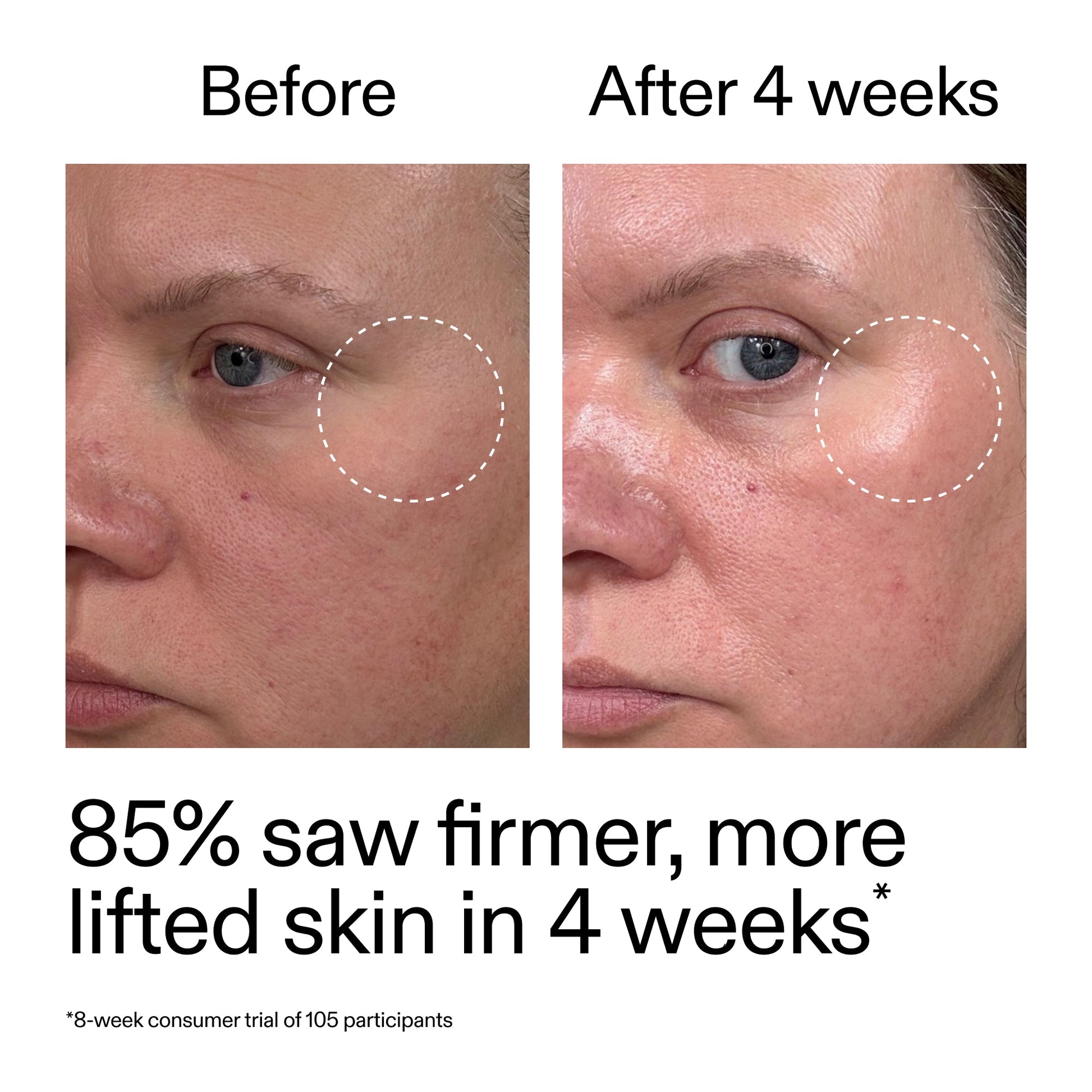 advanced-0-2-retinal-serum-h9 AdvancedRetinal_BeforeAfter_Claim1_2000x2000_bcc385c4-5e73-4f1e-aba8-64267937d0d3.jpg