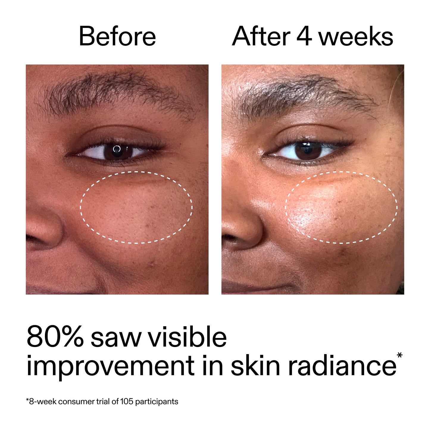 advanced-0-2-retinal-serum-h9 AdvancedRetinal_BeforeAfter_Claim2_2000x2000_39d11e3d-eda9-44ec-ab32-2903b1a368bd.jpg