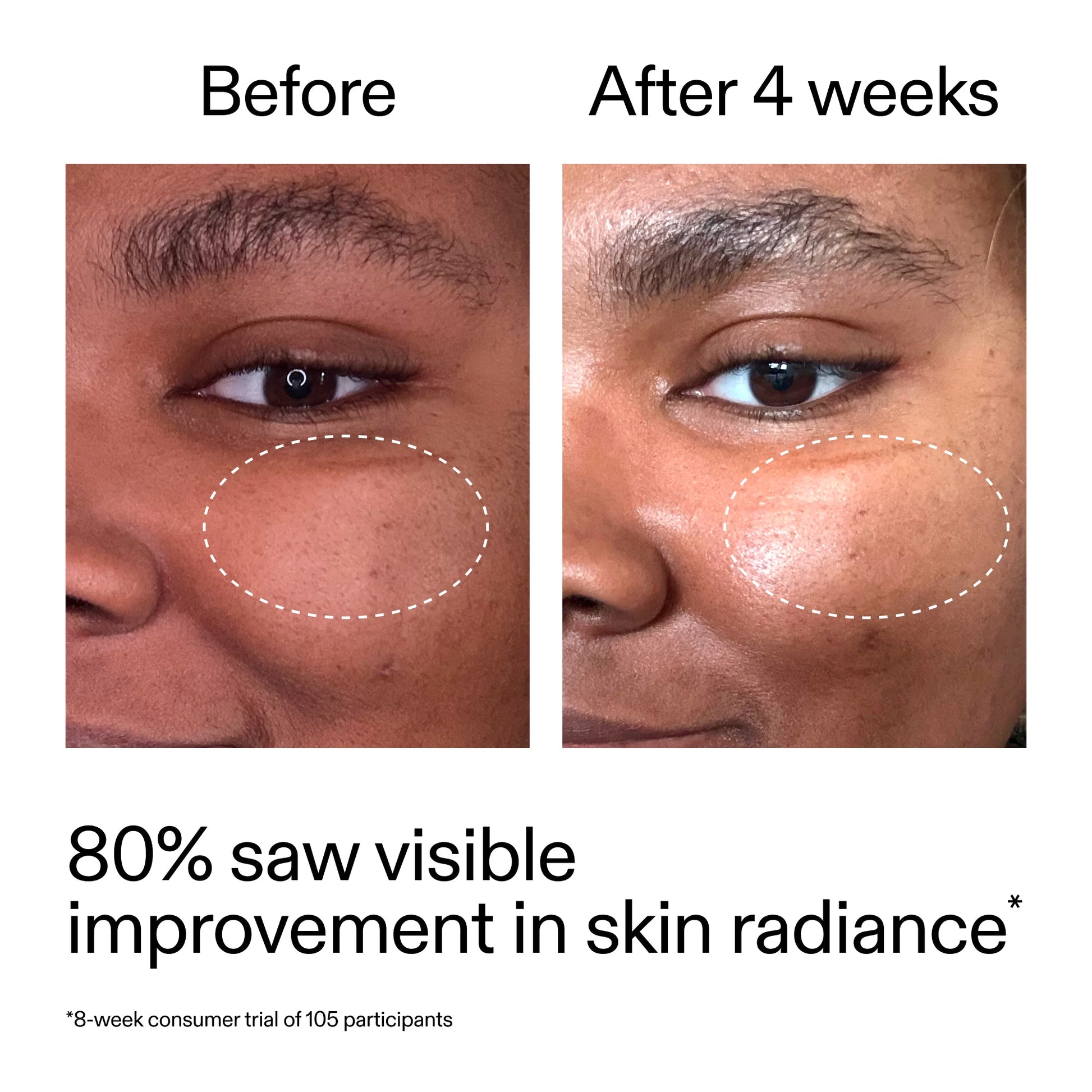 advanced-0-2-retinal-serum-duo-b5 AdvancedRetinal_BeforeAfter_Claim2_2000x2000_681b621d-8d44-4d44-9a40-89244f9b2e53.jpg