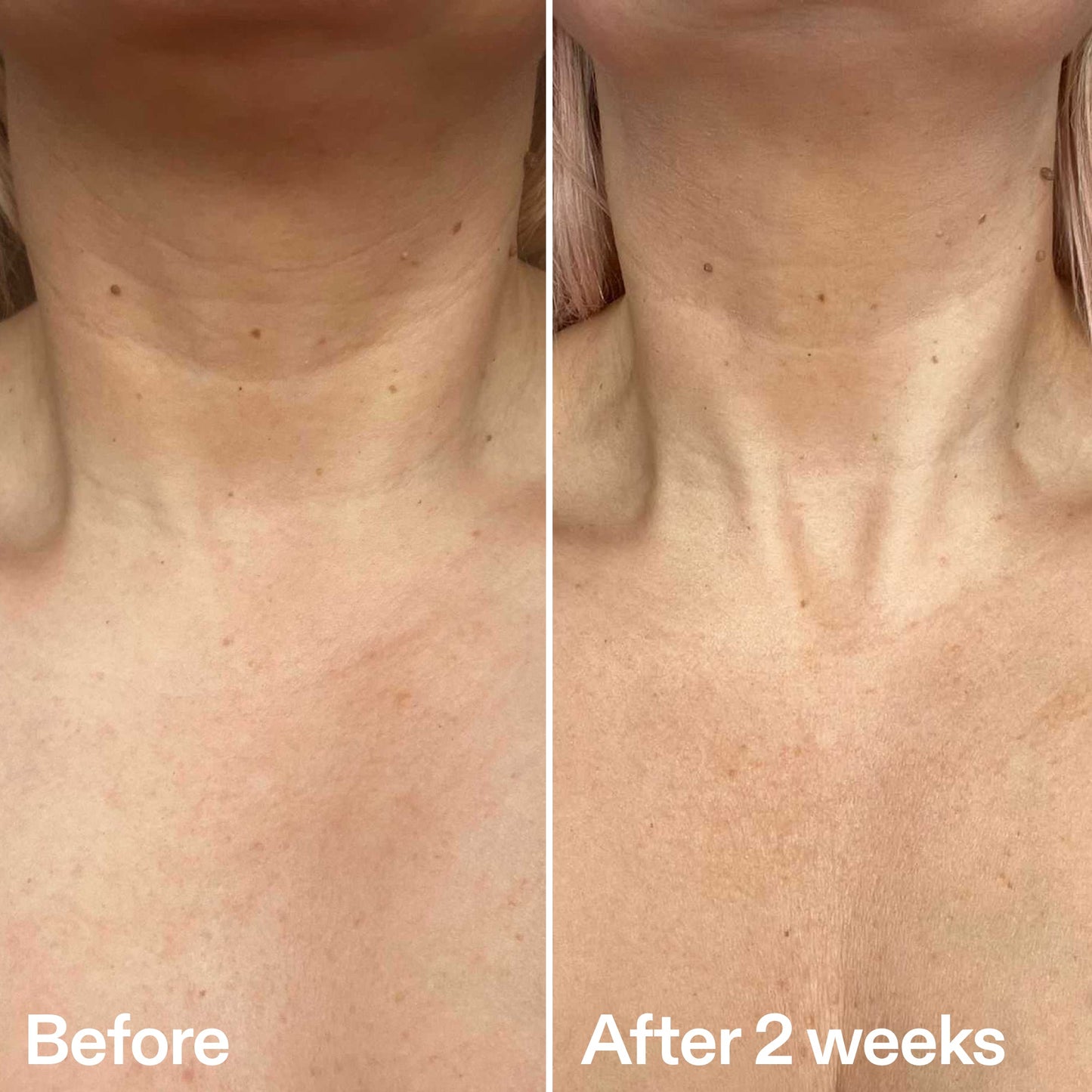 bio-active-neck-lift-stick-s3 B_A_2.jpg