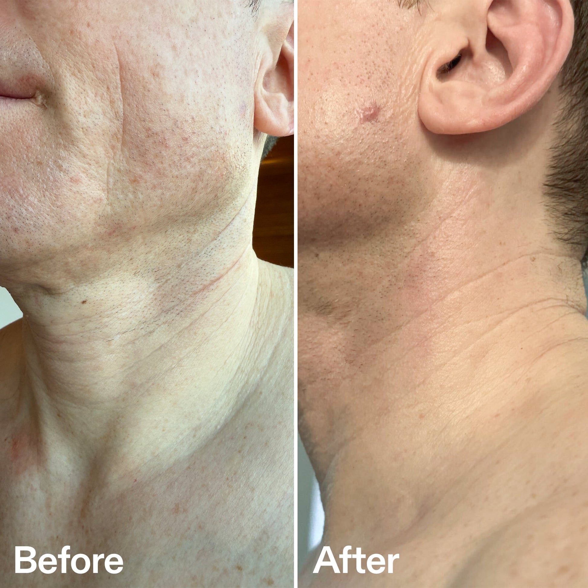 bio-active-neck-lift-stick-s3 B_A_afa2743e-b8e2-4504-92f4-e281cb6cf759.jpg