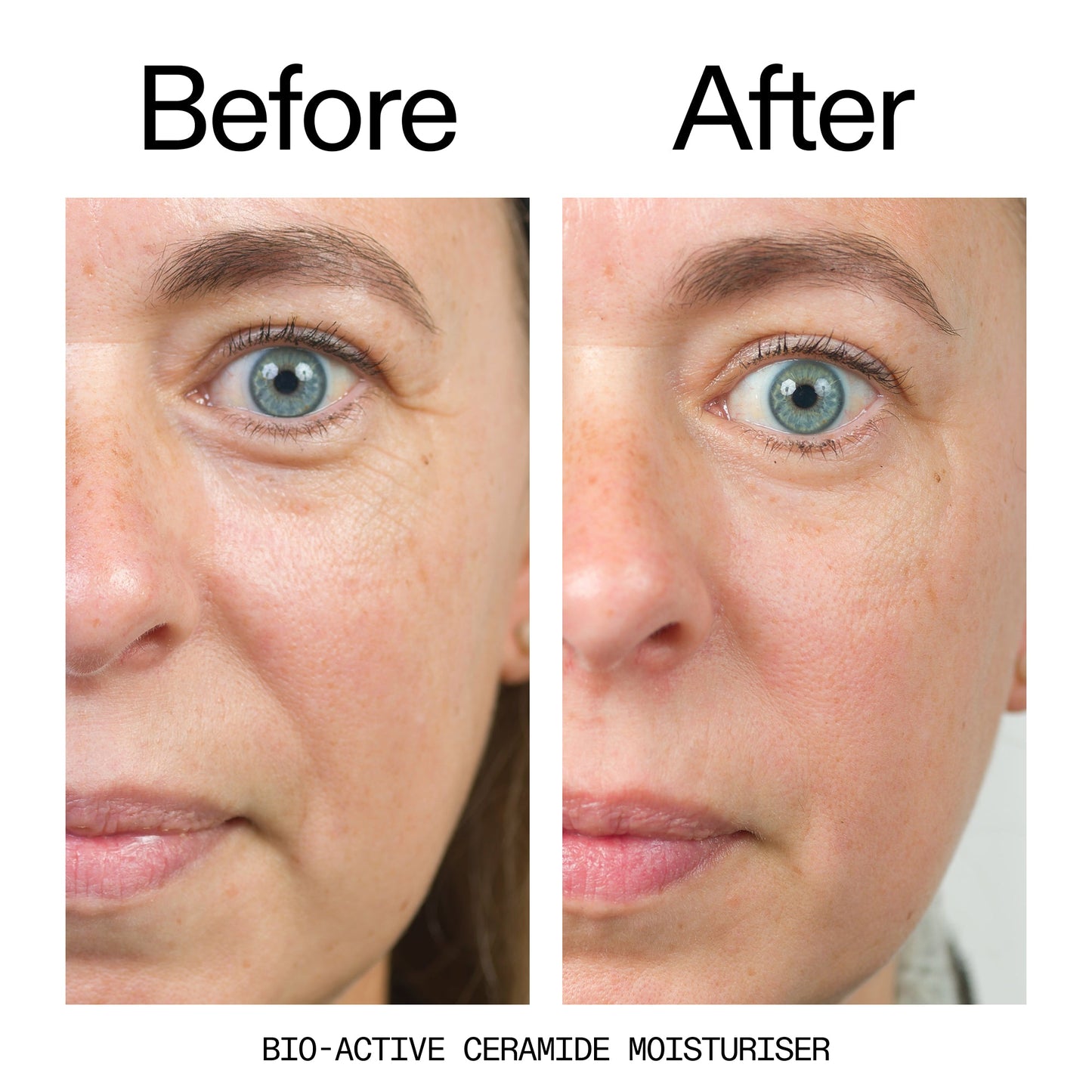barrier-boosting-trio-h8 Bio-Active_Before_After_2000x2000_600947b4-e8c5-425a-9155-fc15bc83aa12.jpg