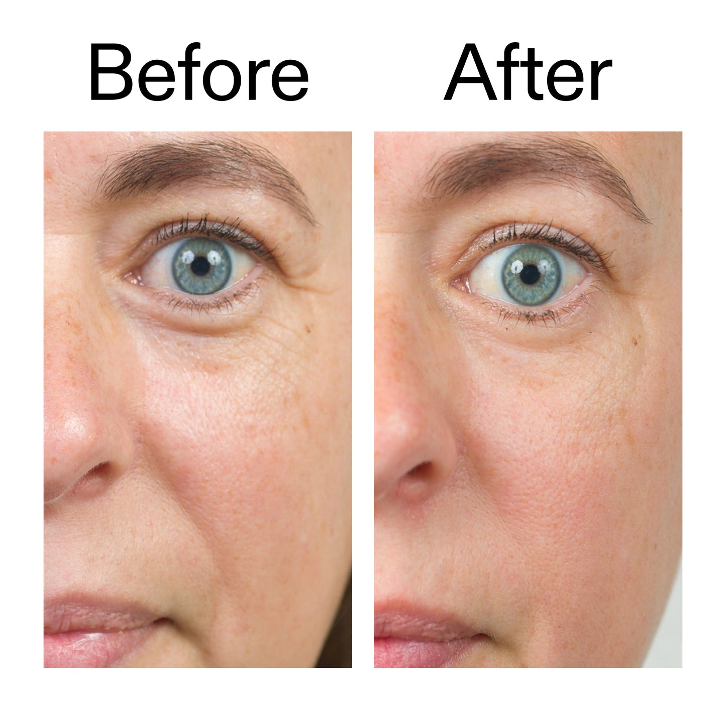 bio-active-ceramide-moisturizer-a4 Bio-Active_Before_After_2000x2000_566e5a9e-135e-417a-8242-b44e5fa35463.jpg