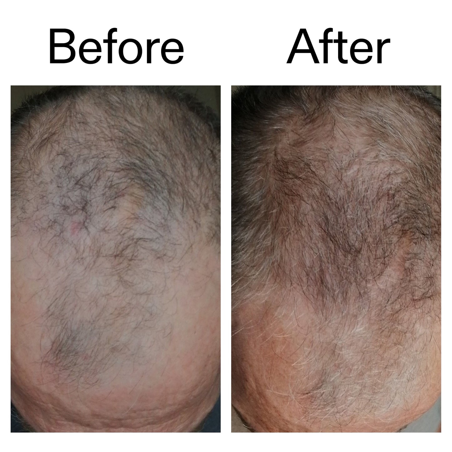 3-month-hair-growth-trio-m1 Caffeine_Scalp_Treatment_B_A_Ppage_2000_x_2000.jpg