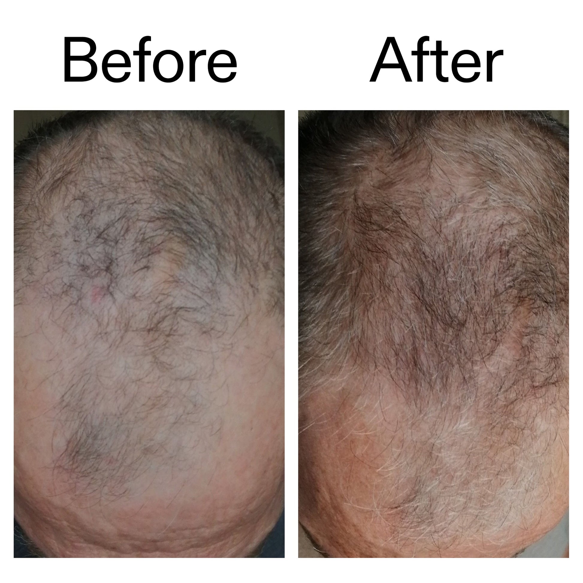 3-month-hair-growth-trio-m1 Caffeine_Scalp_Treatment_B_A_Ppage_2000_x_2000.jpg