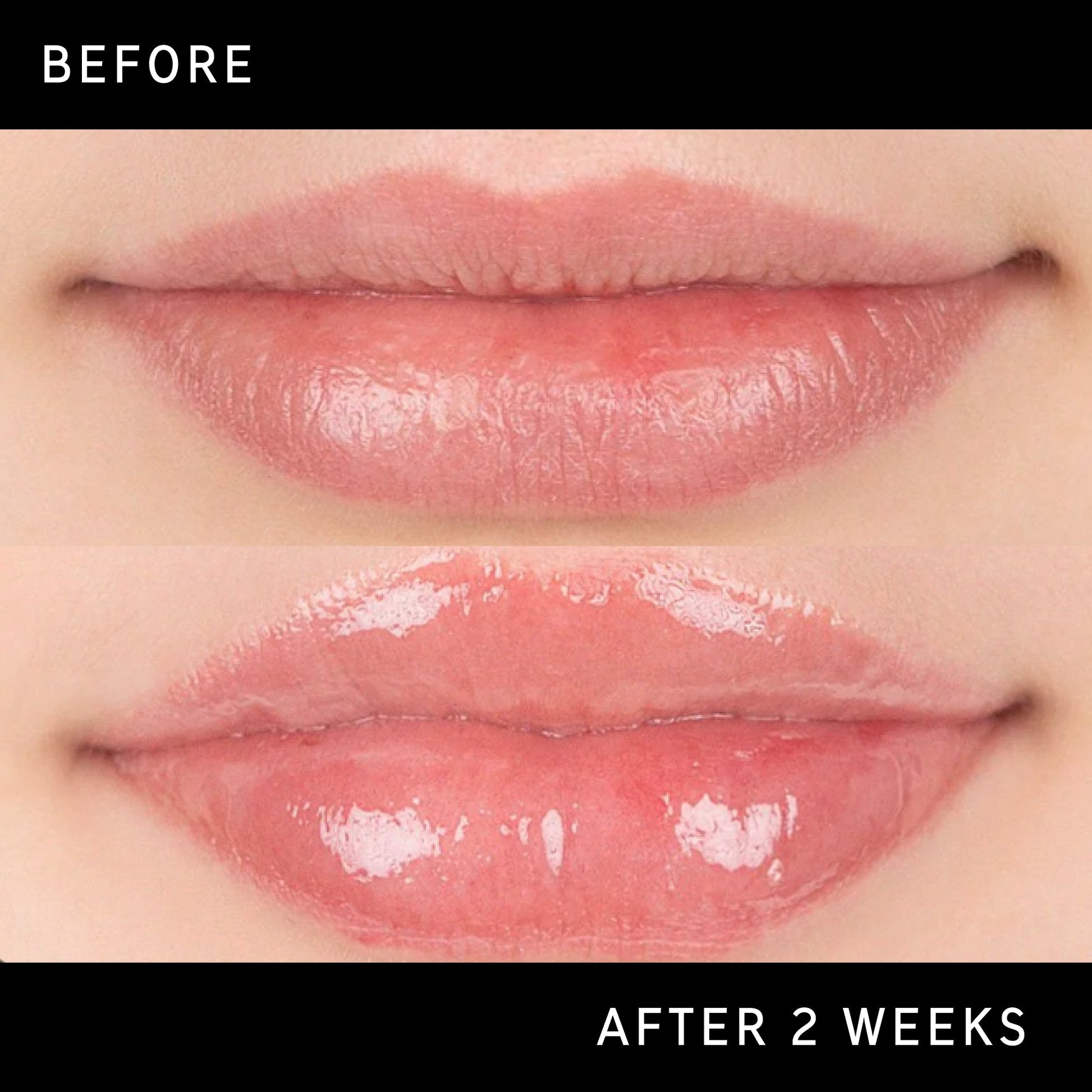 lip-plumping-duo-z2 DTC-Top15_Amends_Tripeptide-Lip_B_A.jpg