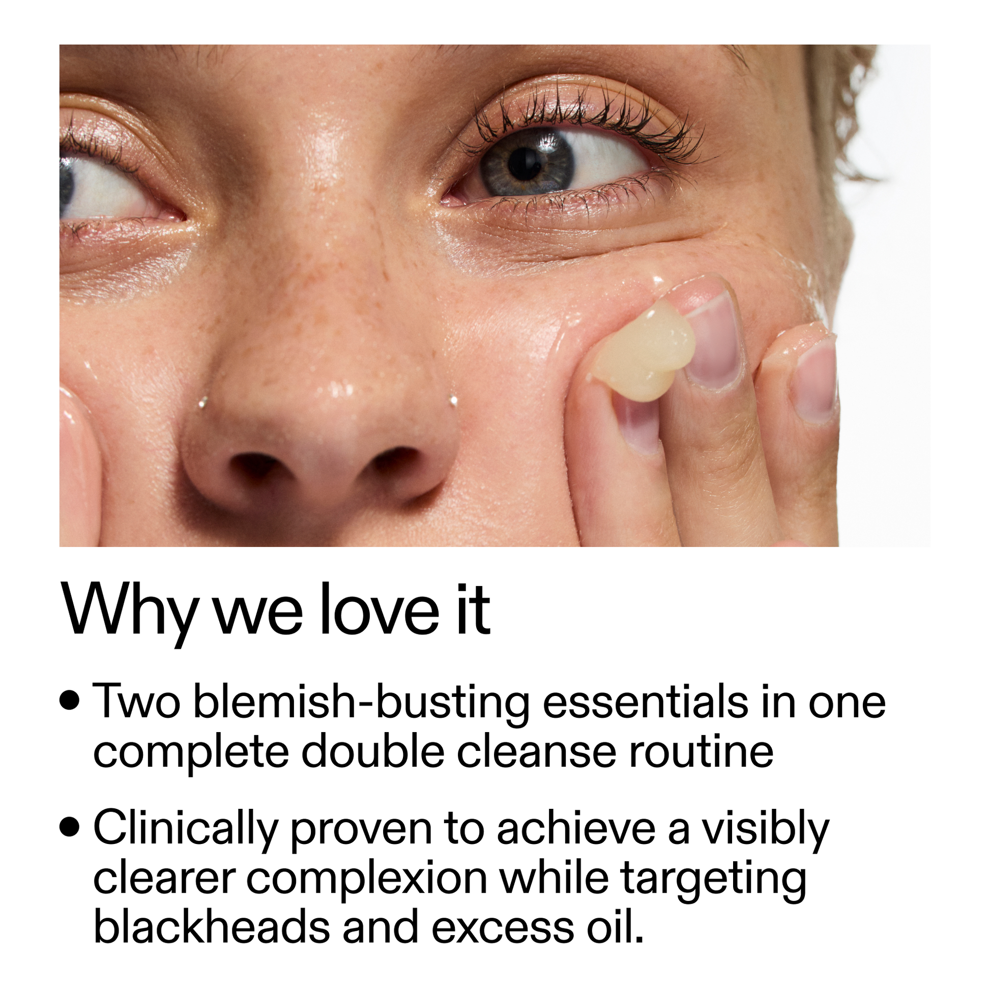 acne-double-cleanse-duo-k5 Double_Cleanse_Duo_for_Breakouts_Why_We_2000x2000_f242cb12-bb5c-487c-b203-071ccb406ec5.png