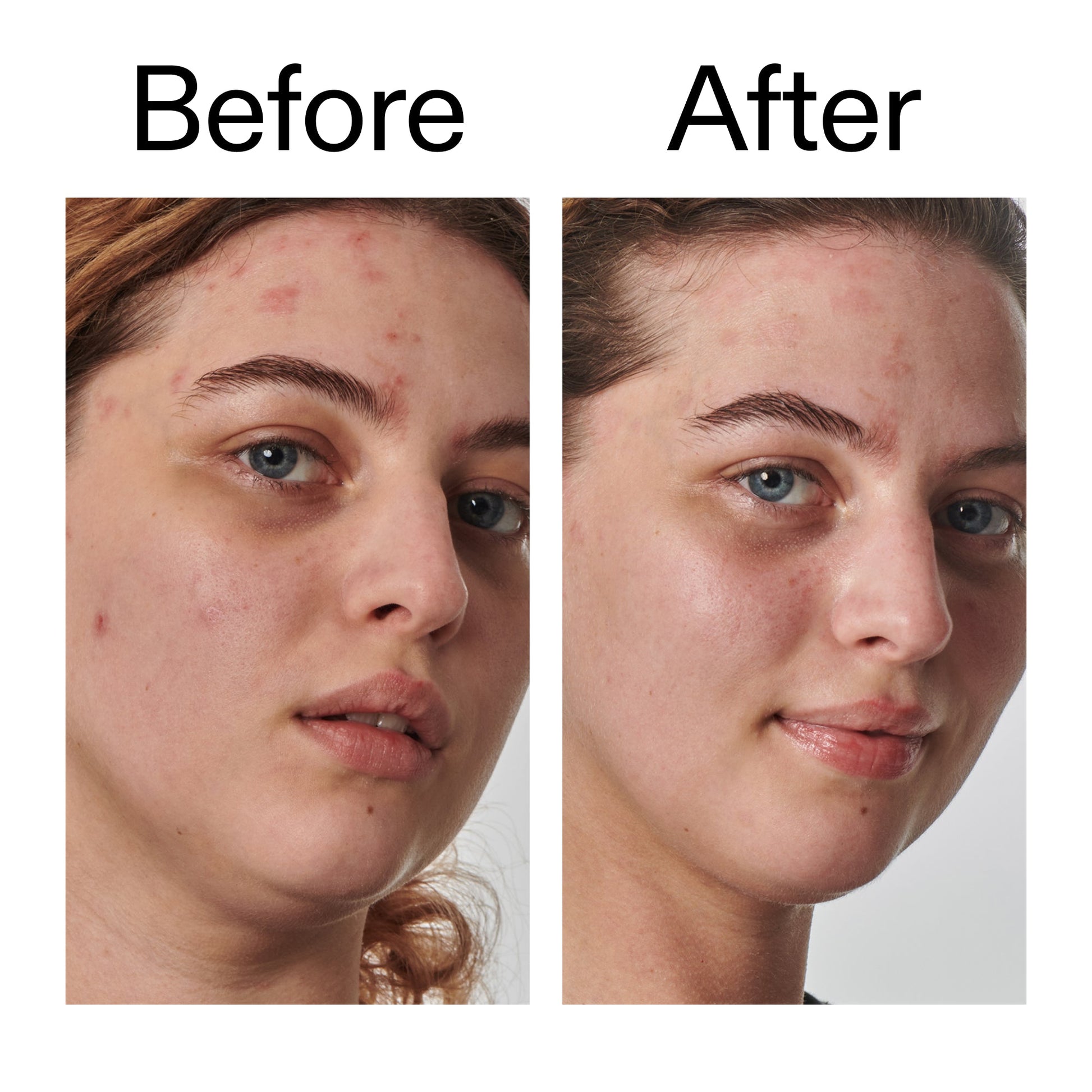 10-urea-moisturizer-o4 Dry_and_Rough_Skin_Solution_Before_After_2000x2000_efa6e639-5c39-49bd-a5dd-f0220293120a.jpg