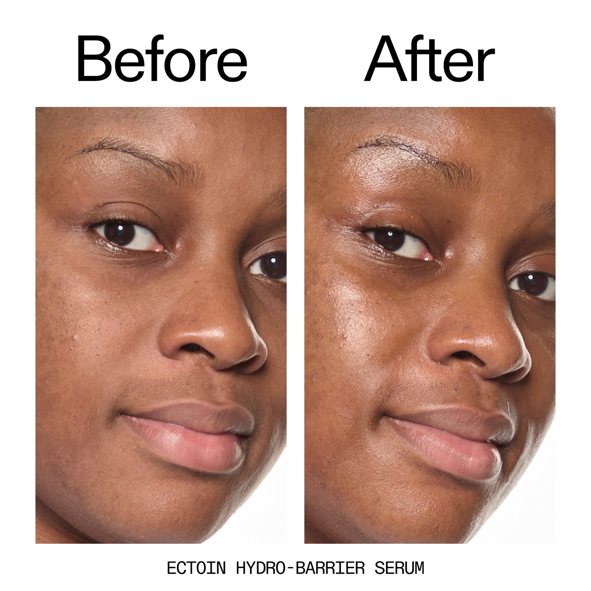 barrier-boosting-trio-h8 Ectoin_Before_After_2000x2000_ce35bc41-4da0-4b6f-adc7-29f8641f6c6c.jpg