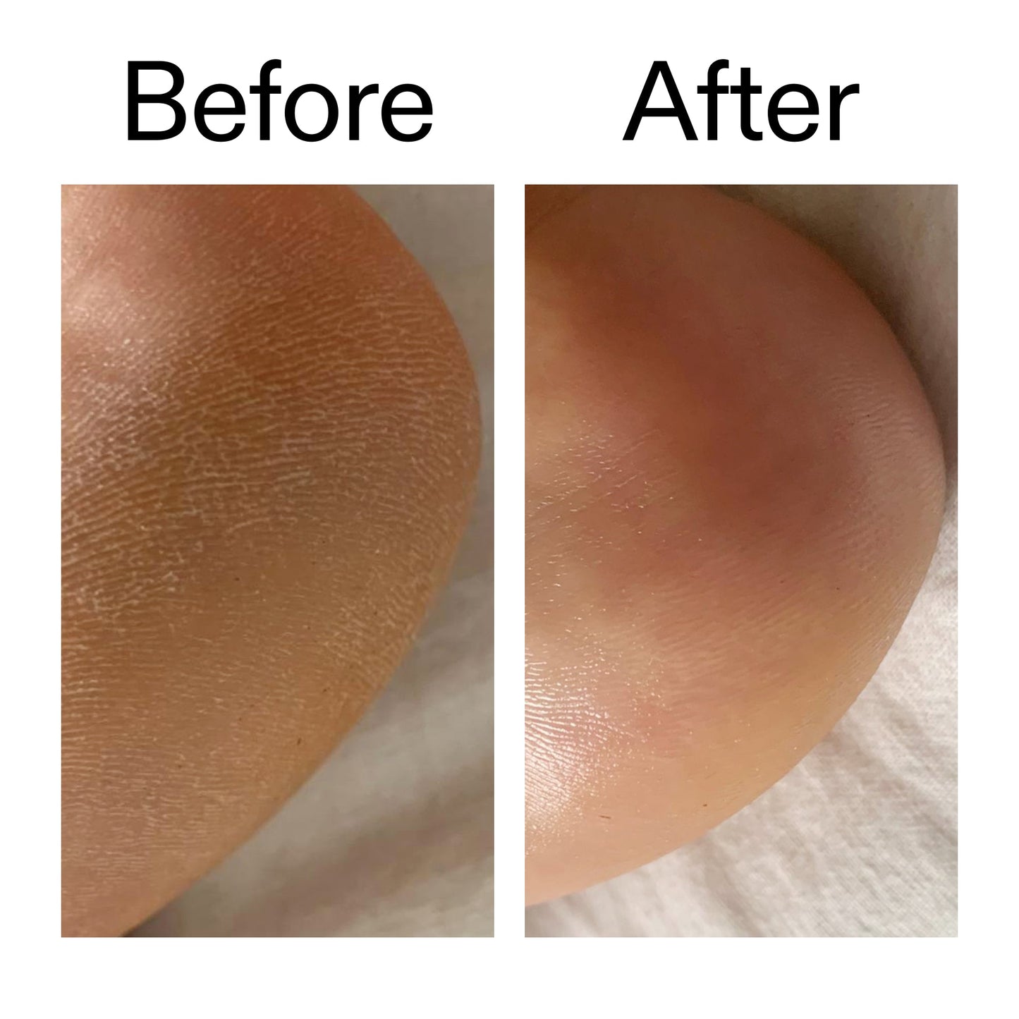 glycolic-acid-exfoliating-body-stick-d1 Glycolic_Acid_Exfoliating_Body_Stick_Before_After_V1_2000x2000_a3043625-9400-429a-a7fb-d6dbd220f722.jpg