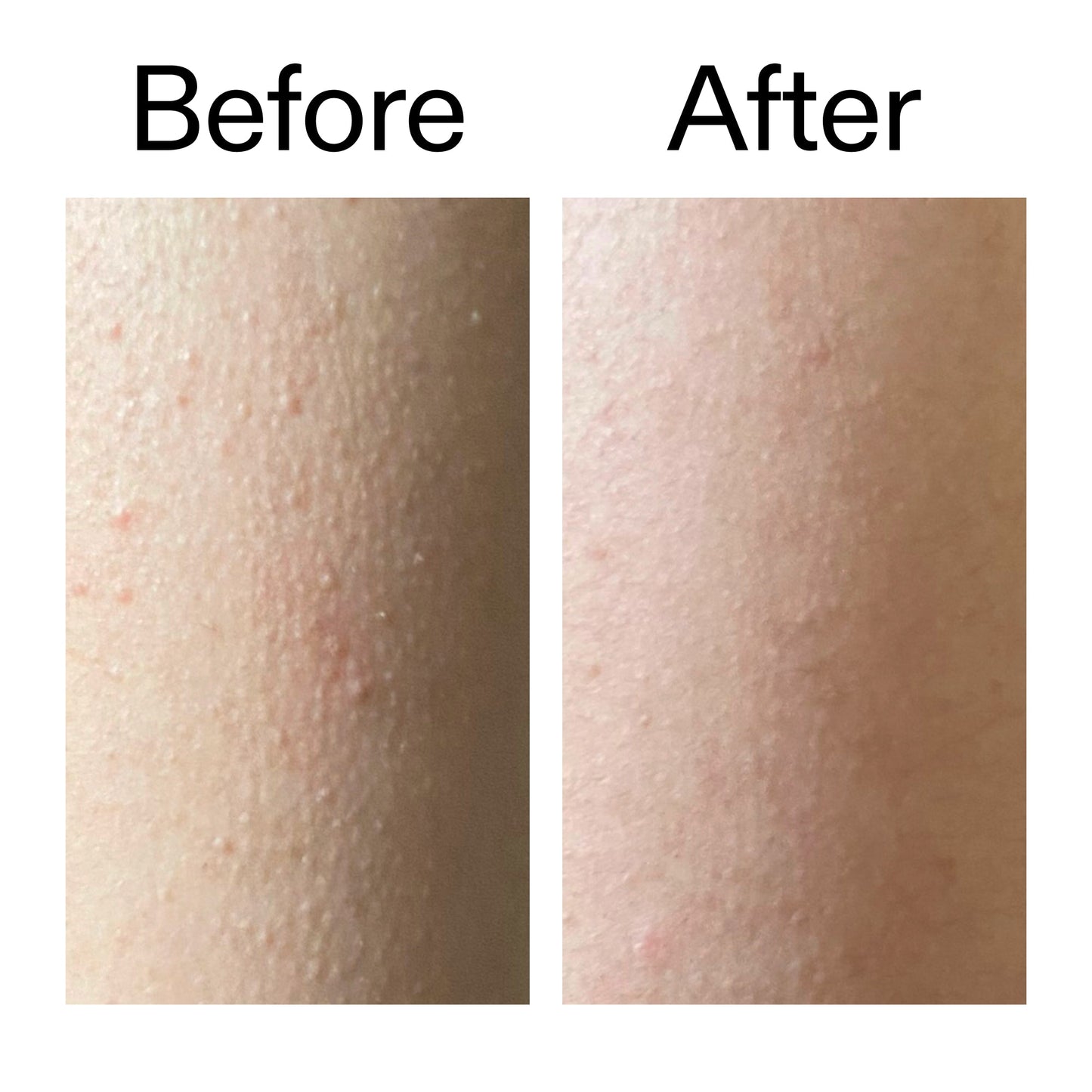 glycolic-acid-exfoliating-body-stick-duo-j5 Glycolic_Acid_Exfoliating_Body_Stick_Before_After_V2_2000x2000_2e4ba052-94f6-4d56-82df-7bdb5b2df7ae.jpg
