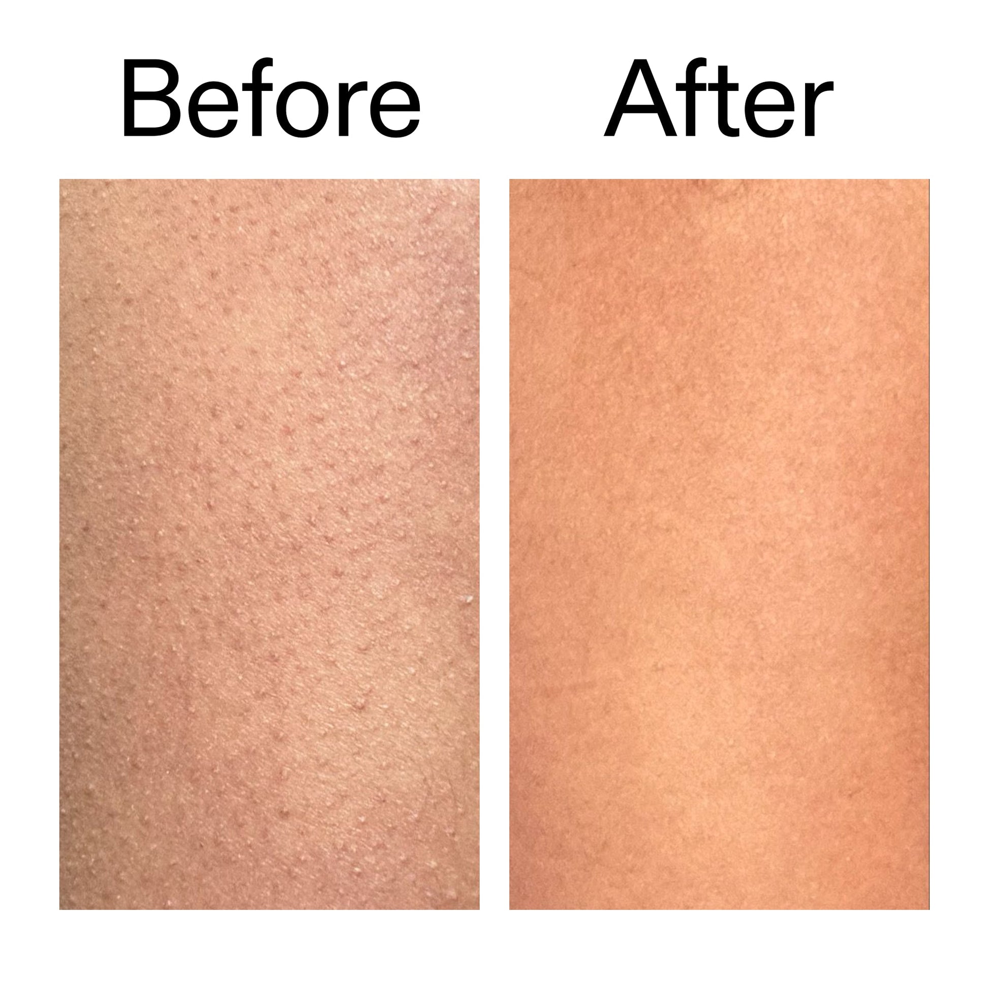 glycolic-acid-exfoliating-body-stick-d1 Glycolic_Body_Stick_B_A_2000x2000_6e6e6b4d-5bd7-43c0-aeed-4d66788e8995.jpg