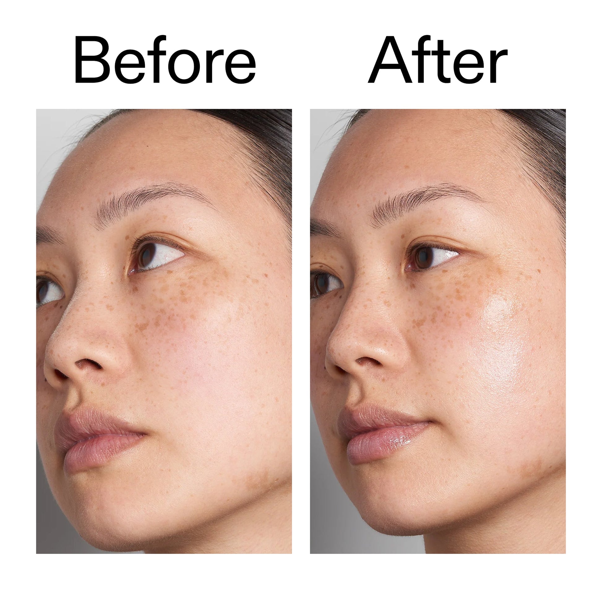 hyaluronic-acid-serum-60ml-b4 Hyaluronic_Acid_Before_After_2000x2000_d7983956-8aa2-4ea3-8255-c63e8d4f892e.jpg