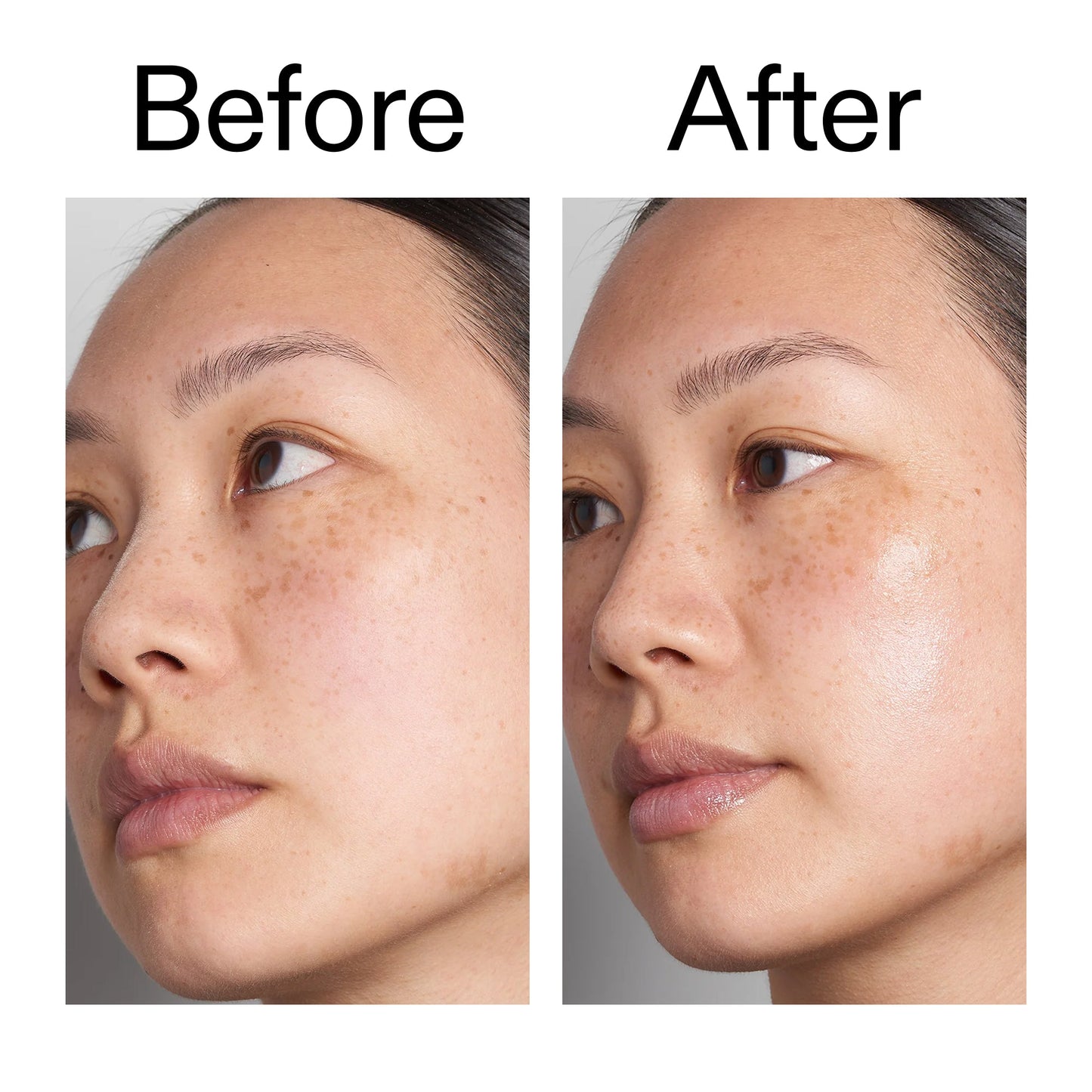 supersize-hyaluronic-acid-serum-100ml-duo-j1 Hyaluronic_Acid_Before_After_2000x2000_d7983956-8aa2-4ea3-8255-c63e8d4f892e.jpg