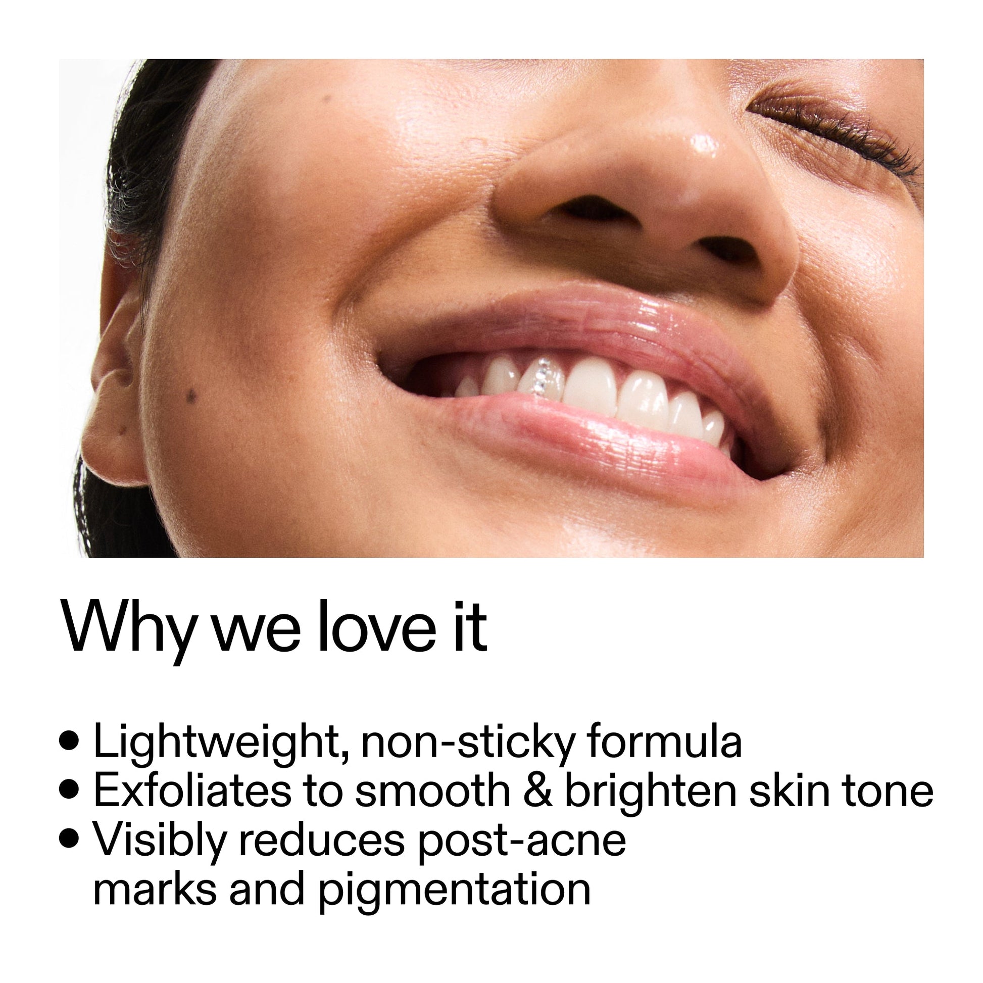 mandelic-acid-treatment-a4 Mandelic_Acid_Treatment_Why_we_love_it_2000x2000_6dfe29a9-2a79-464f-a5e8-e5ac37d93388.jpg
