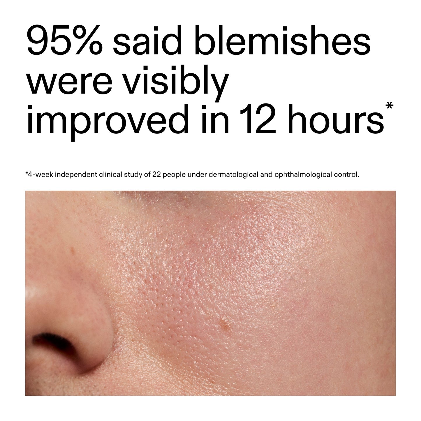 succinic-acid-acne-treatment-n9 Oat_Cleansing_Balm_Claim_2000x2000_ac6ce553-25db-41b2-a981-faae1ac4b8c0.jpg