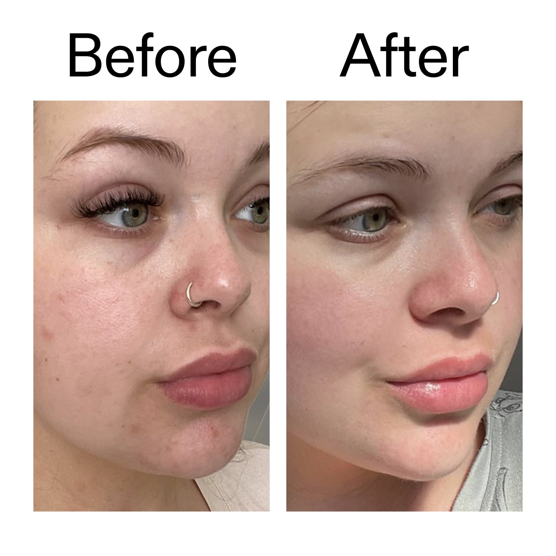 supersize-omega-water-cream-100ml-s1 Omega50_Before_After_2000x2000_46483ed8-3f9d-487f-9a0c-9df79830bd65.jpg