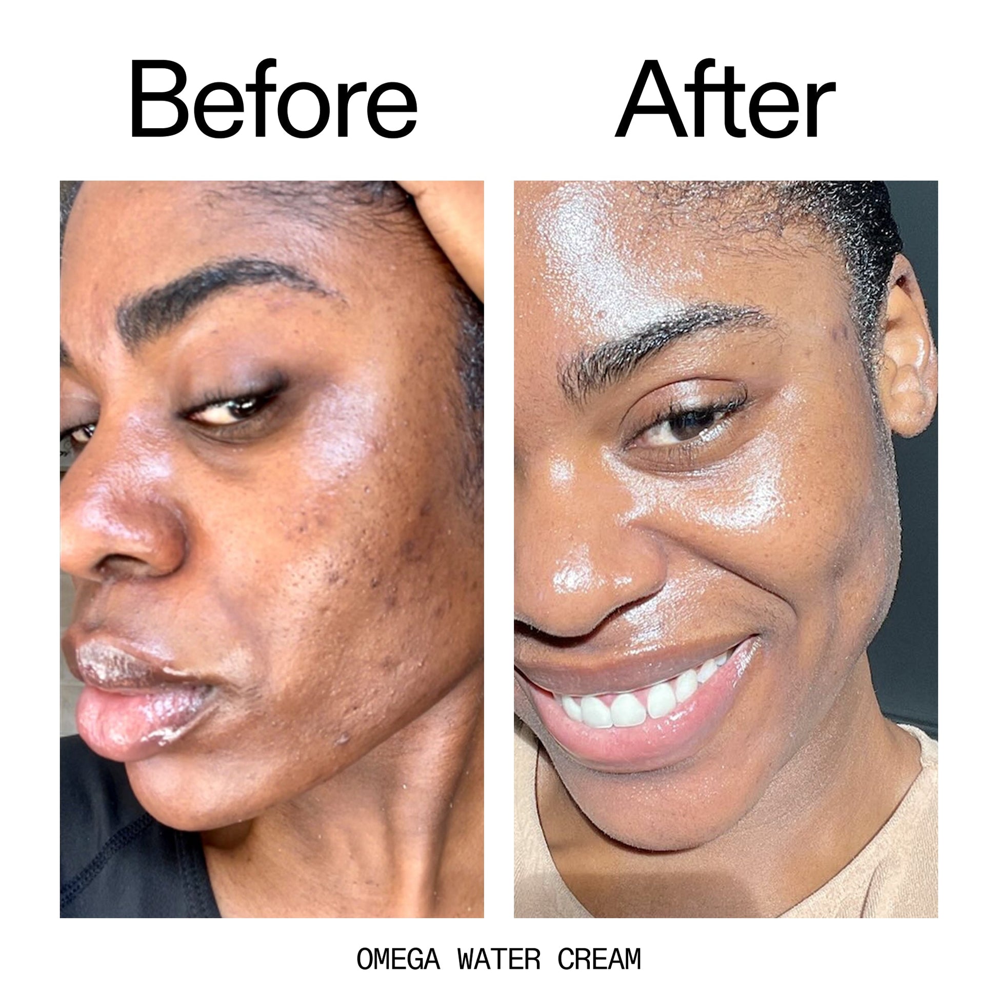 glowing-skin-set-u3 Omega_Water_Cream_Before_After_2000x2000_8e88278b-8c8d-48dc-ac77-4e98ebbd1b77.jpg