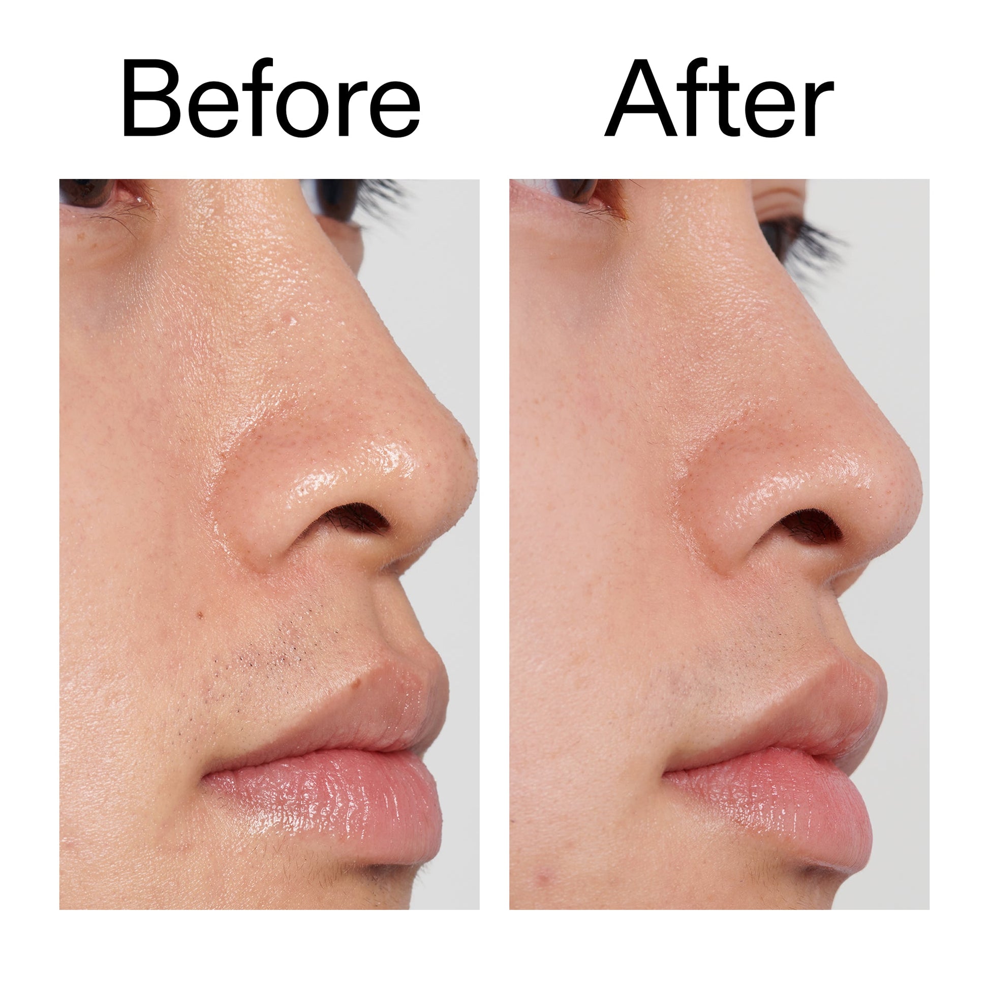 pha-toner-n8 PHA_Toner_Before_After_2000x2000_e3c10172-0150-4342-8b95-57417eaff50d.jpg