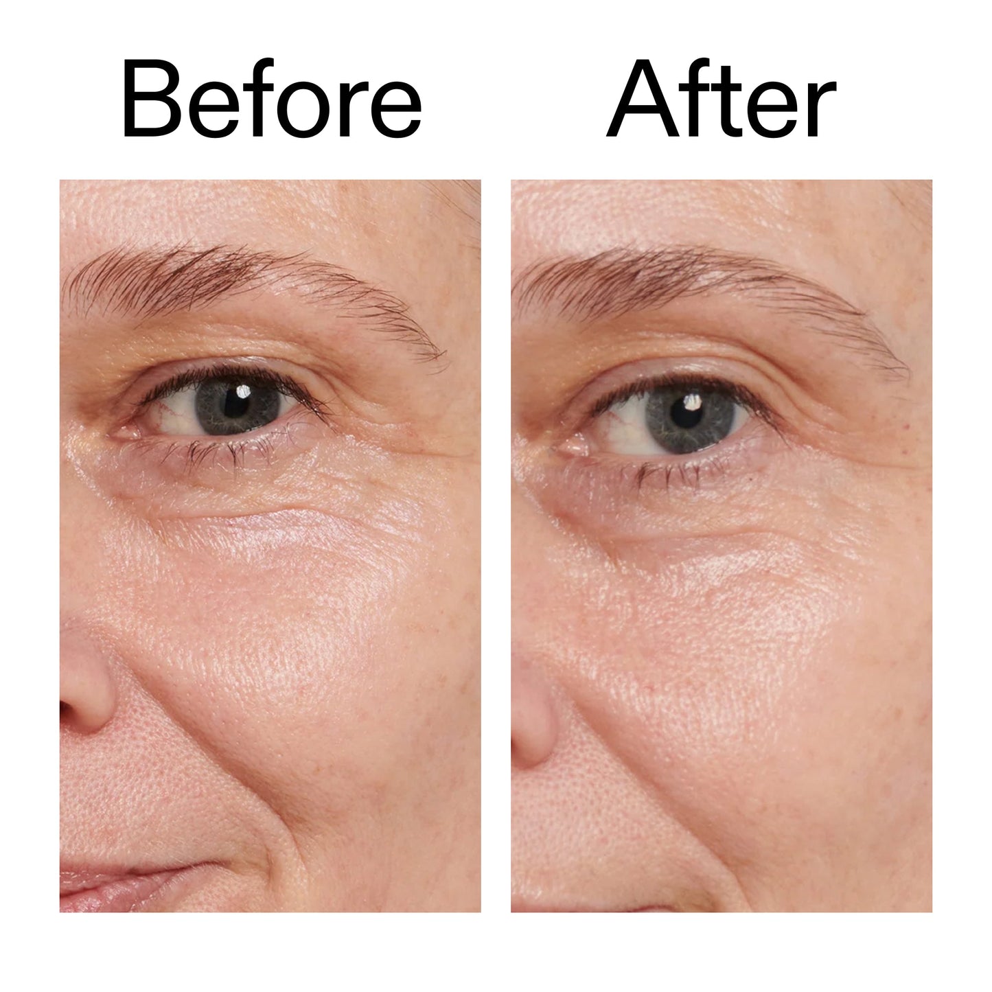 retinol-eye-cream-r1 Retinol_Eye_Cream_Before_After_2000x2000_ac03a80c-109e-4572-a95a-91dc109b4d27.jpg