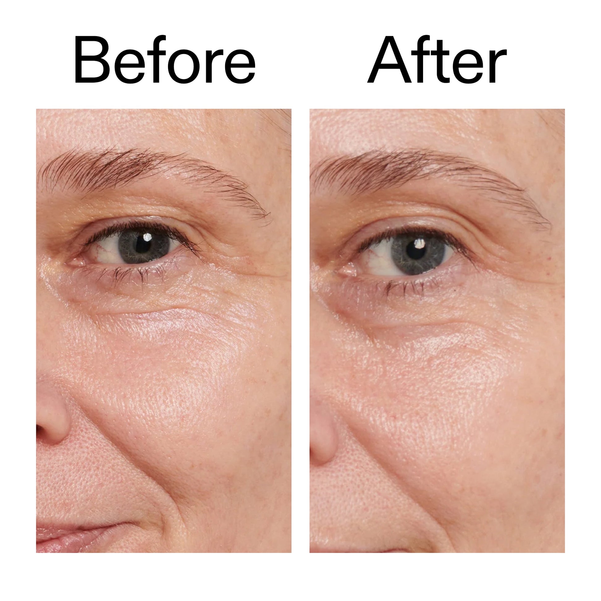 retinol-eye-cream-r1 Retinol_Eye_Cream_Before_After_2000x2000_ac03a80c-109e-4572-a95a-91dc109b4d27.jpg