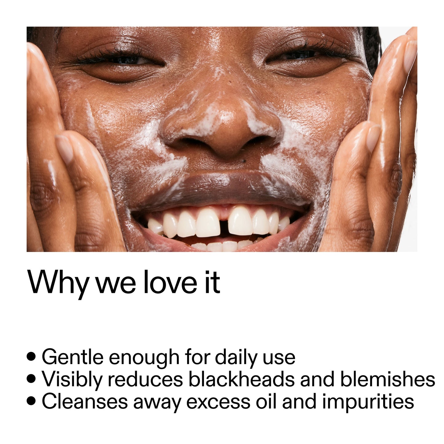 salicylic-acid-cleanser-150ml-i3 Salicylic_Acid_Cleanser_-_300mlWhy_we_love_it_2000x2000_87dc92a9-2559-4309-98cd-4e570f1be735.jpg