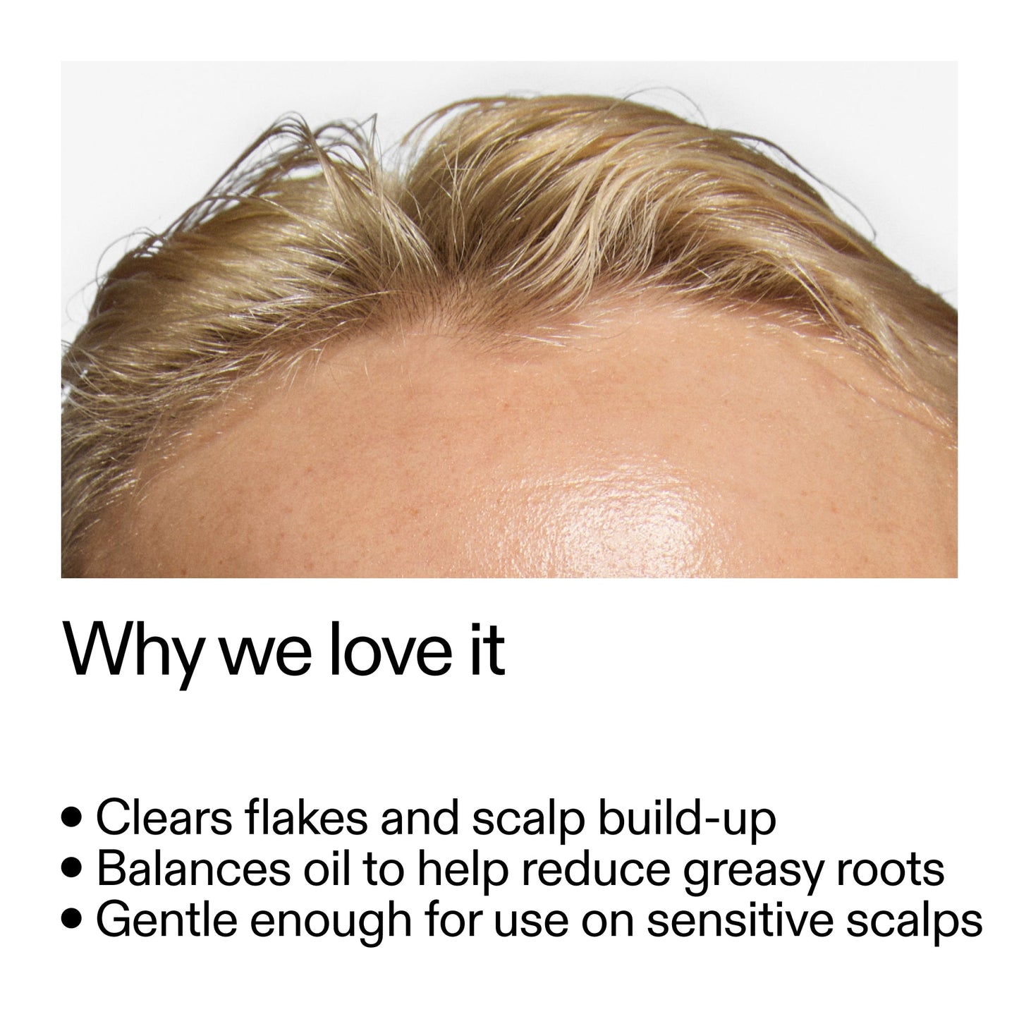 salicylic-acid-exfoliating-scalp-treatment-m3 Salicylic_Acid_Exfoliating_Scalp_Treatment_Why_we_love_it_2000x2000_44b6bd6d-9ec4-4b23-9dc4-bc3fd6f28e14.jpg