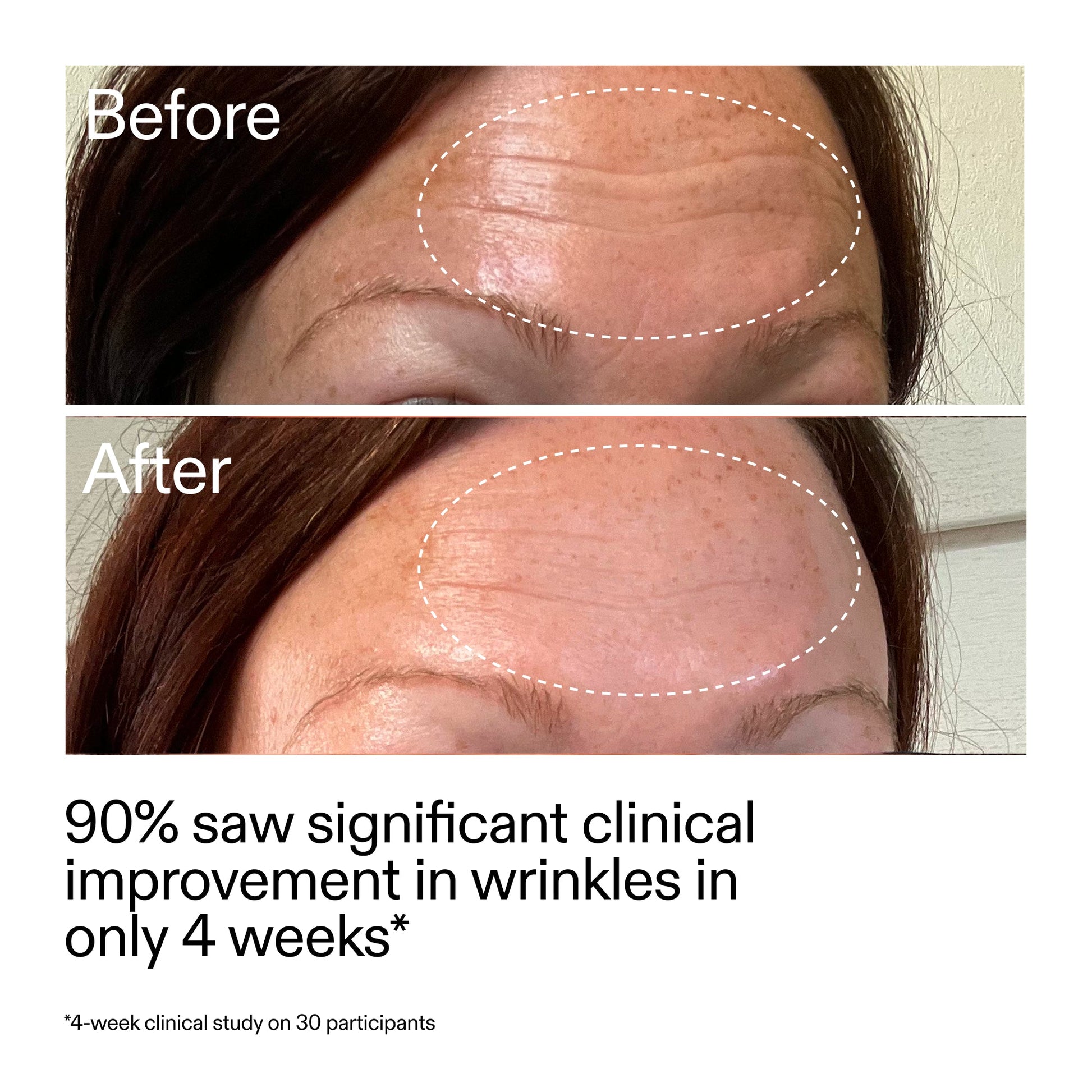 starter-retinol-serum-duo-i7 StarterRetinol_BeforeAfter_Claim1_2000x2000_03b4d6e5-a357-43b9-a855-aba5e35c57f3.jpg