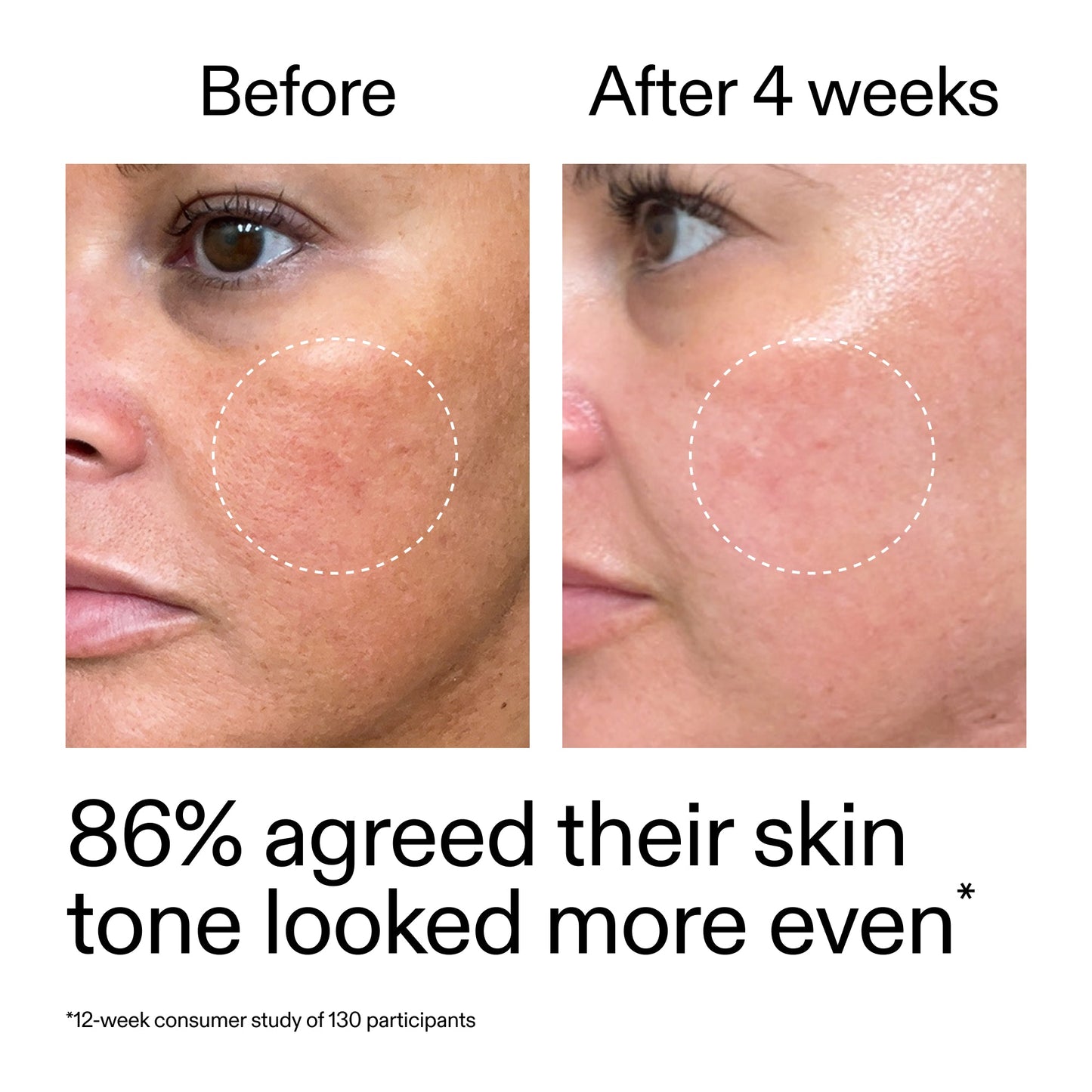 starter-retinol-serum-d6 StarterRetinol_BeforeAfter_Claim2_2000x2000_f5c9ecc0-8d76-429d-bef5-c3a61bcf5c09.jpg