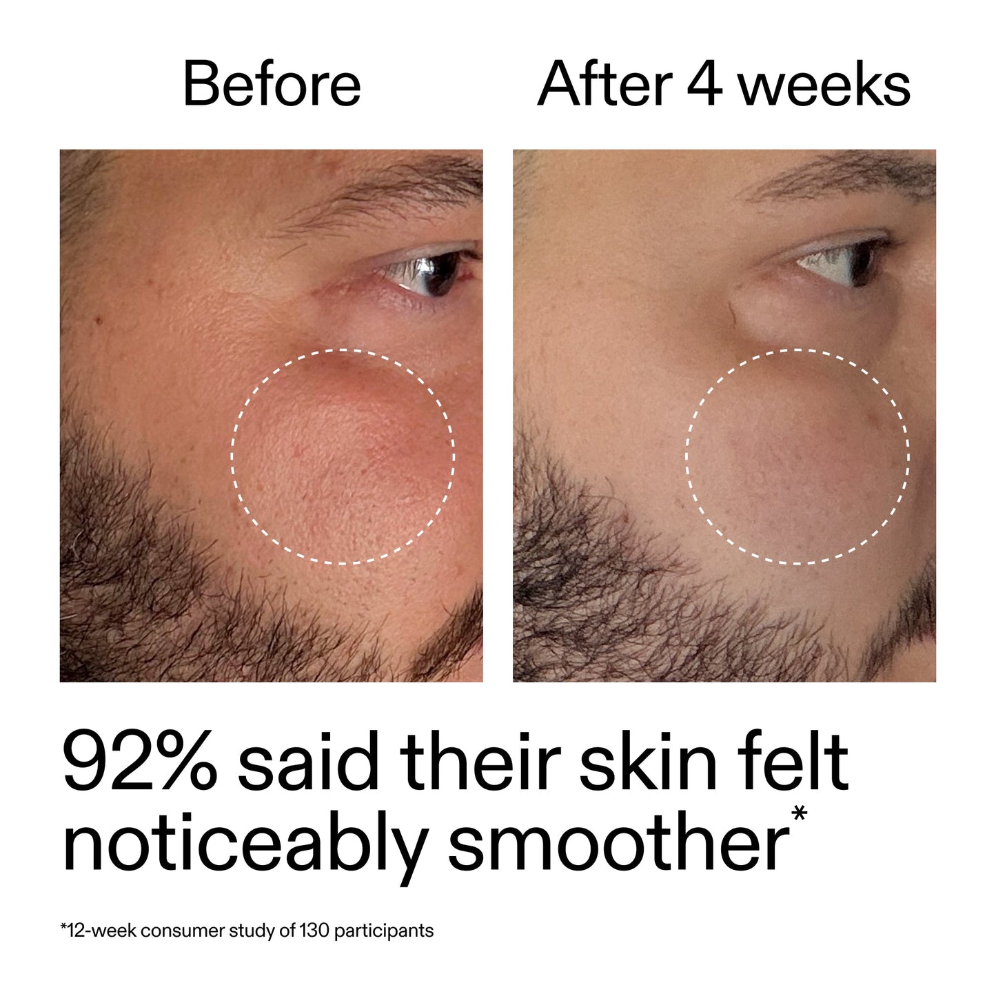 starter-retinol-serum-d6 StarterRetinol_BeforeAfter_Claim3_2000x2000_6ceab106-e0ee-4ed4-ba62-41bc39538038.jpg