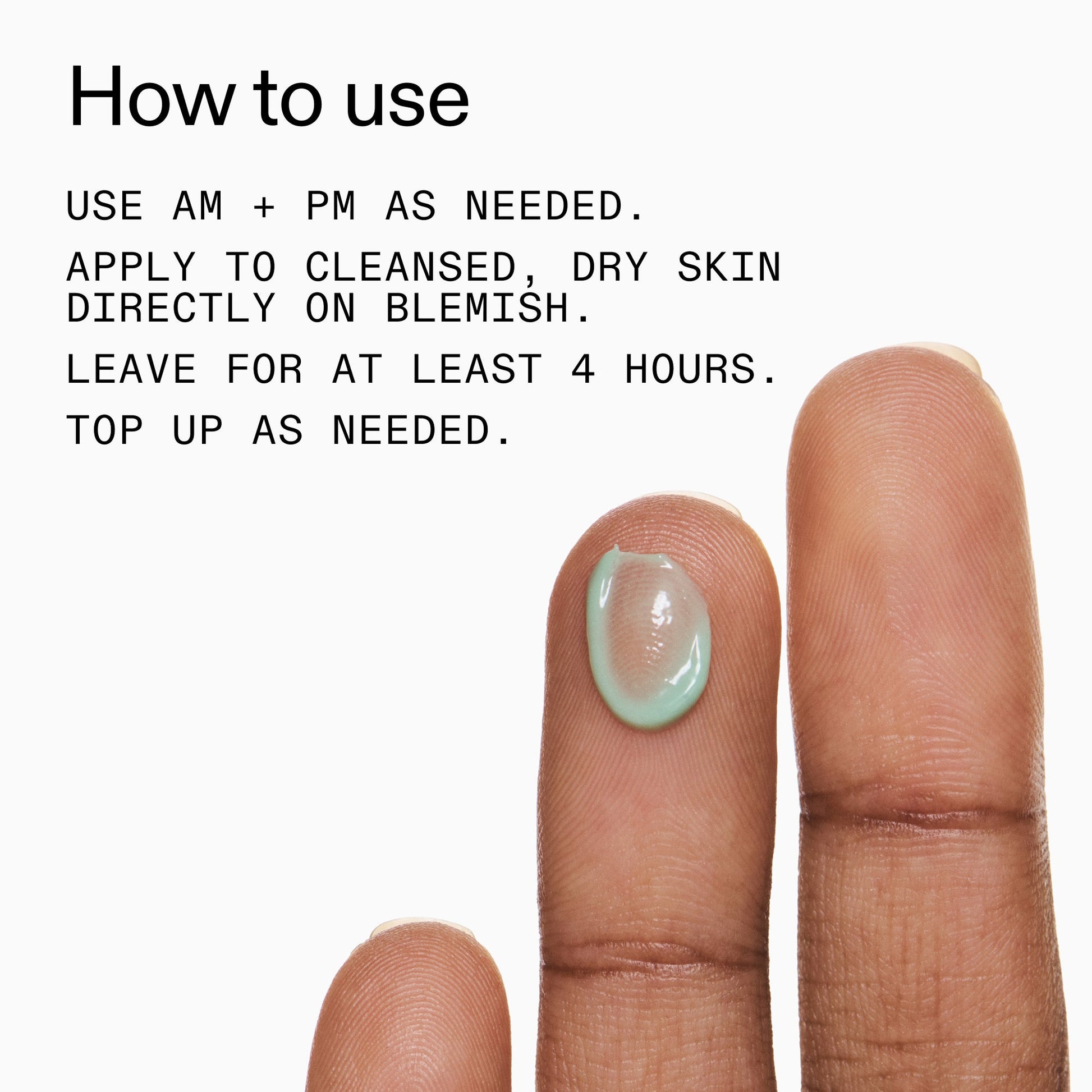 succinic-acid-acne-treatment-n9 Succinic_Acid_Treatment_How_to_Use_2000x2000_d57137d5-d7f1-427c-9a46-5fc00c19c542.jpg