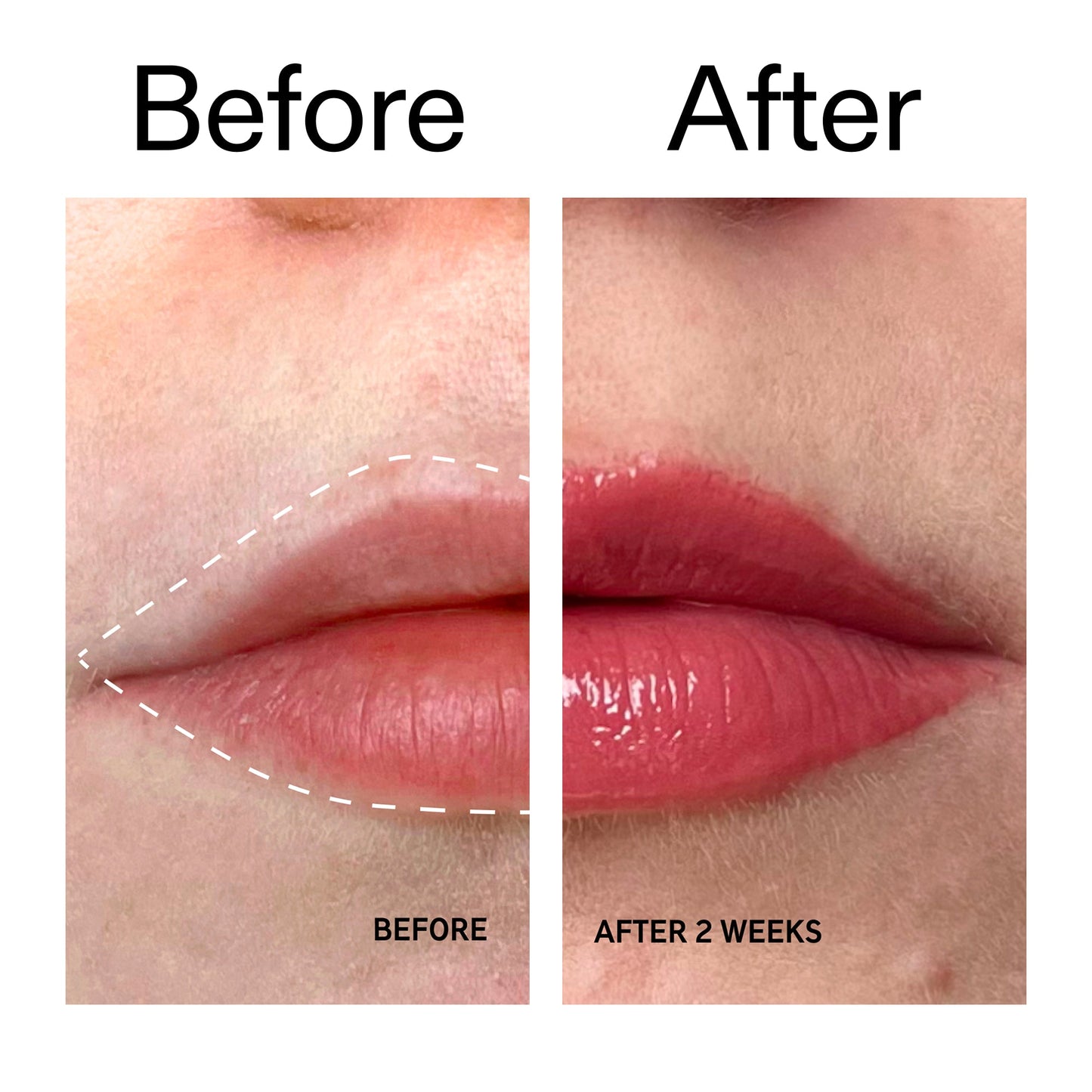 tripeptide-plumping-berry-lip-balm-k0 Tripeptide_Plumping_Lip_Balm_-_Berry_Before_After_2000x2000_9474bbd8-43ca-4b0e-b0e7-dfab70b91927.jpg