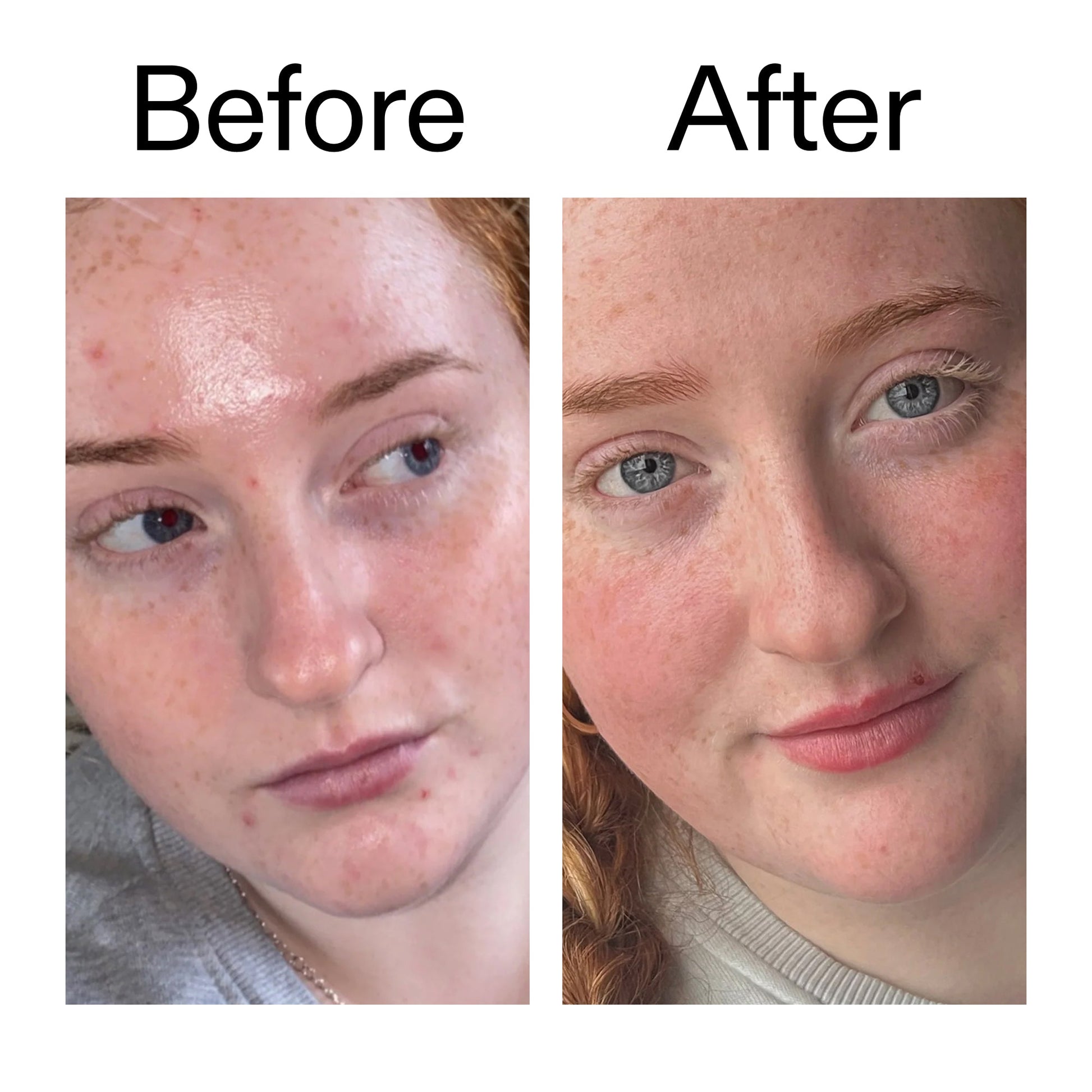 vitamin-b-c-and-e-moisturizer-f3 Vitamin_B_C_and_E_Moisturizer_Before_After_2000x2000_b0781a76-5ad2-4be9-95b8-ef92b356833c.jpg